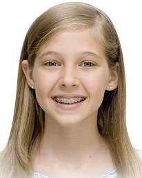 smiling girl with braces